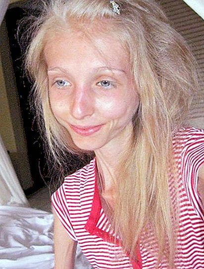 Ksenia Bubenko: una historia de su enfermedad