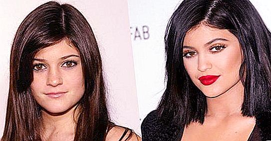 Jenner Kylie: Før og efter reinkarnationer