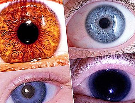 A cor mais rara dos olhos - o que é?