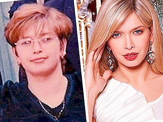 Spoiled or prettier? What did Russian celebrities look like in their youth when no one else knew about them