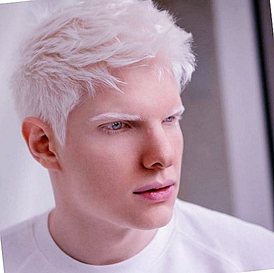 The albino model from Georgia showed the world his soul mate: the beauty of this couple is so unusual that people cannot describe it in words. Photo