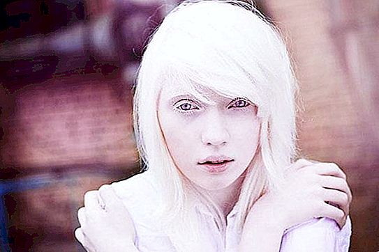 Nastya Zhidkova: standart olmayan bir görünüme sahip bir albino modeli