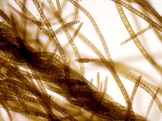 Ganggang filamen: peringkat perkembangan, pembiakan, bagaimana untuk menghapuskan dari akuarium?