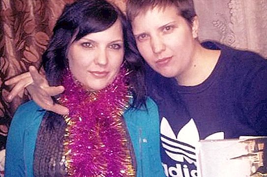 Cặp song sinh Xiêm ở Nga - Anya và Tanya Korkina sau 26 năm