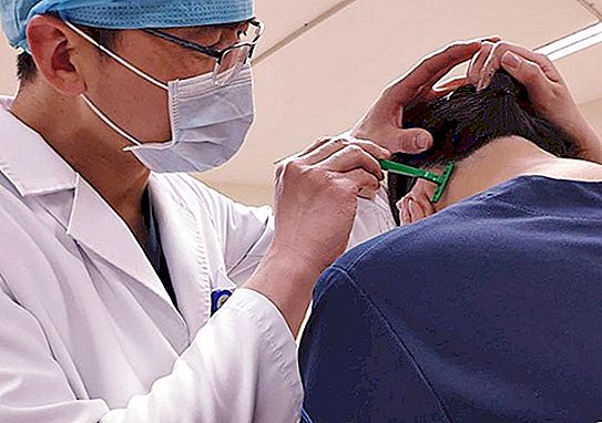 Nowe środki ochrony przed koronawirusem Wuhan: pielęgniarki w szpitalach zmuszone do przycinania włosów i golenia świątyń