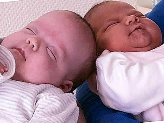 Um verdadeiro milagre médico: uma mulher deu à luz gêmeos em anos diferentes, com uma diferença de 3 meses