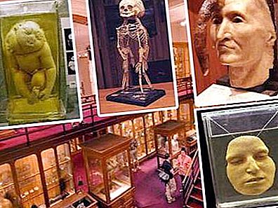 Mutter Museum für Medizingeschichte, PA: Geschichte, Exponate, Fotos