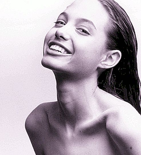 Plastikoperationer af Angelina Jolie: før og efter fotos, resultater af operationer