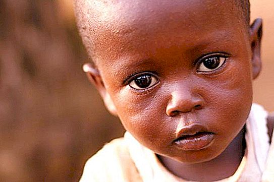 Trẻ em châu Phi: điều kiện sống, sức khỏe, giáo dục
