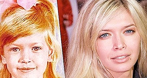 A aparência de Vera Brezhneva antes e depois da cirurgia plástica