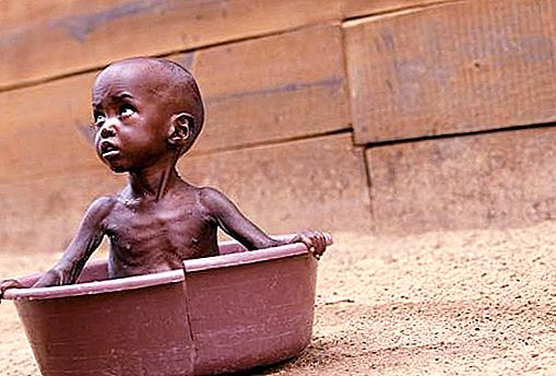 アフリカの飢饉