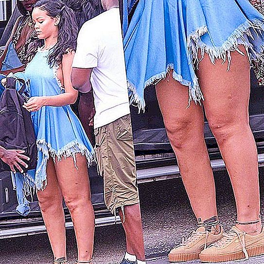 Mga tagahanga sa pagkabigla - ang mga binti ni Rihanna ay "tumakas" mula sa kanyang pantalon