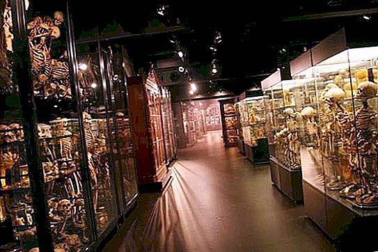 Anatomijos muziejus. Sukrečiantys anatominių pasaulio muziejų eksponatai