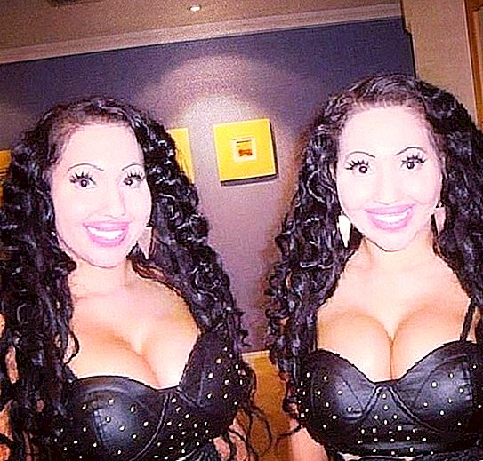 33-year-old sisters called "the most identical twins in the world" want to marry the same guy