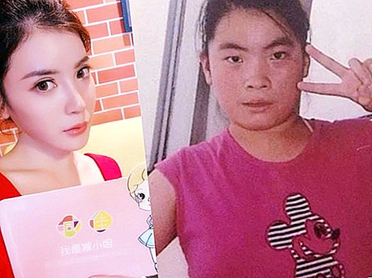 Classmates laughed at her because of her appearance. The girl made 13 suspenders and lost weight - what she looks like now