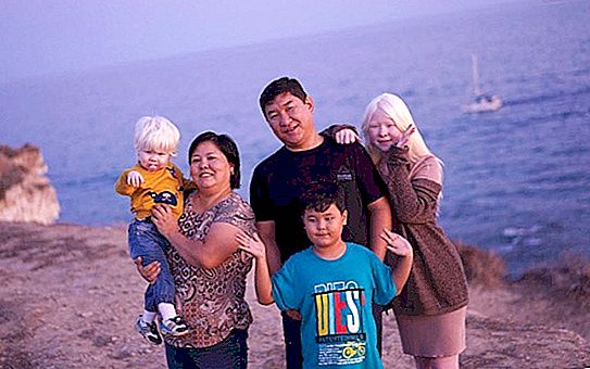 Le frère des sœurs albinos qui ont conquis le monde - une copie exacte des parents: photo